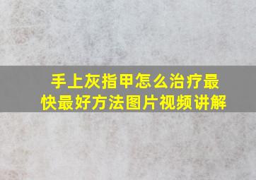 手上灰指甲怎么治疗最快最好方法图片视频讲解