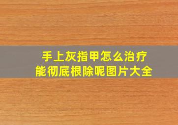 手上灰指甲怎么治疗能彻底根除呢图片大全