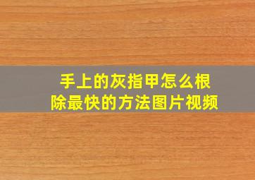 手上的灰指甲怎么根除最快的方法图片视频