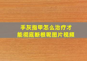 手灰指甲怎么治疗才能彻底断根呢图片视频