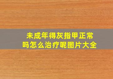 未成年得灰指甲正常吗怎么治疗呢图片大全