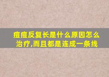 痘痘反复长是什么原因怎么治疗,而且都是连成一条线