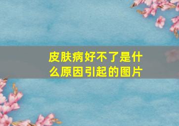 皮肤病好不了是什么原因引起的图片