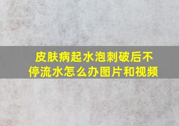 皮肤病起水泡刺破后不停流水怎么办图片和视频