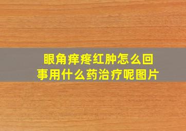 眼角痒疼红肿怎么回事用什么药治疗呢图片