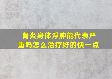 肾炎身体浮肿能代表严重吗怎么治疗好的快一点