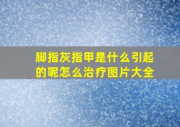 脚指灰指甲是什么引起的呢怎么治疗图片大全