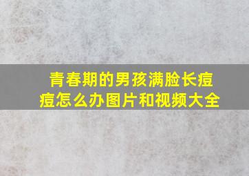 青春期的男孩满脸长痘痘怎么办图片和视频大全