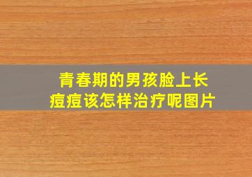 青春期的男孩脸上长痘痘该怎样治疗呢图片