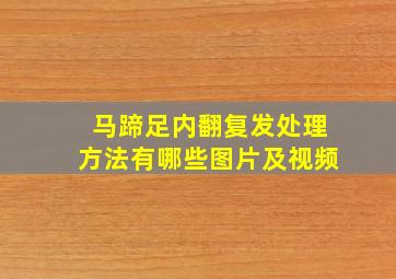 马蹄足内翻复发处理方法有哪些图片及视频