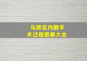 马蹄足内翻手术过程图解大全