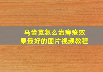 马齿苋怎么治痔疮效果最好的图片视频教程