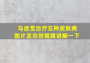 马齿苋治疗五种皮肤病图片及功效视频讲解一下