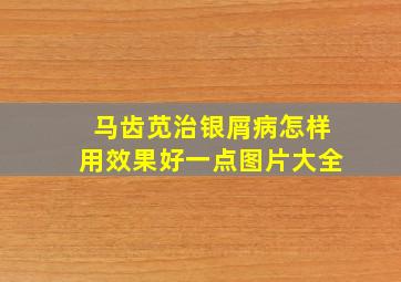 马齿苋治银屑病怎样用效果好一点图片大全